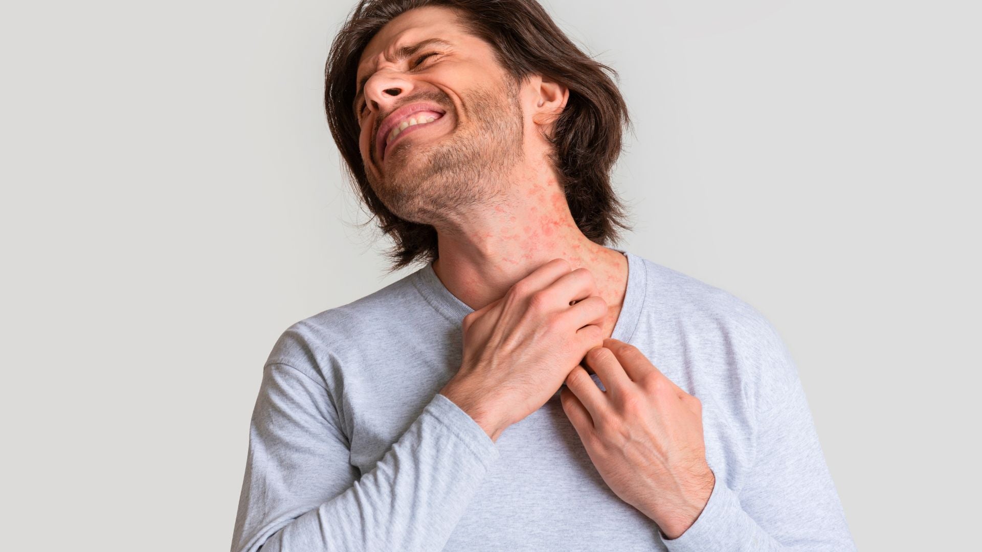 How Coix Seed Helps Skin Hydration & Eczema Relief